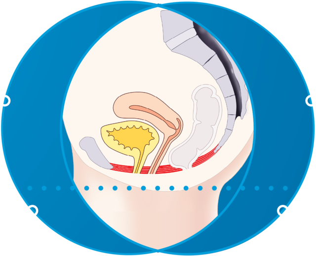 Diagram of the pelvic floor during treatment for EMfemme 360 feminine health treatment in Amsterdam